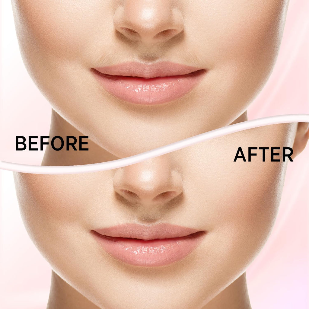 Facial Hair Removal for Women L282
